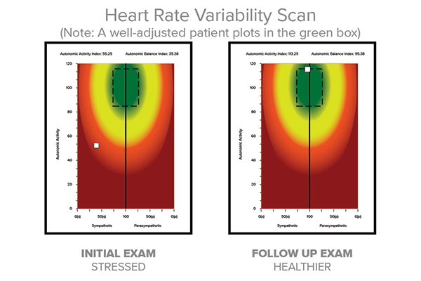 Chiropractic Edina MN Heart Rate Variability Scan