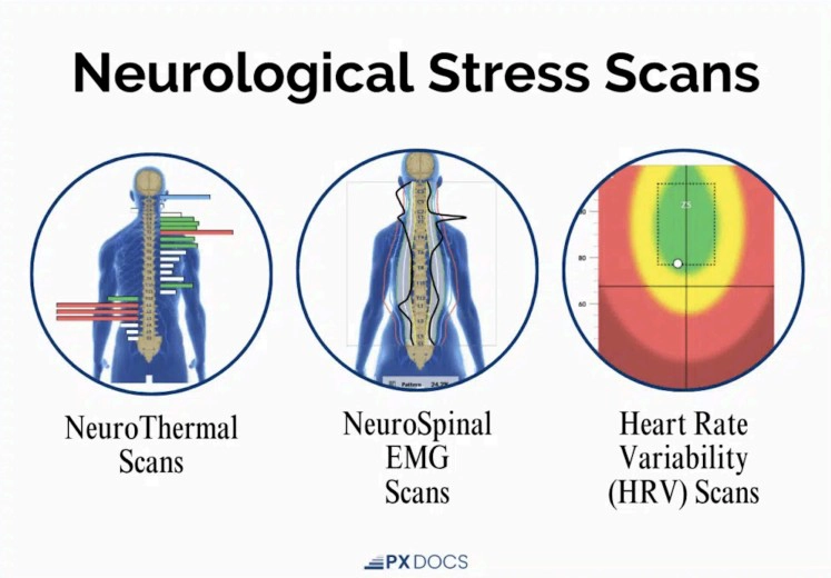 Chiropractic Edina MN Neurological Stress Scan